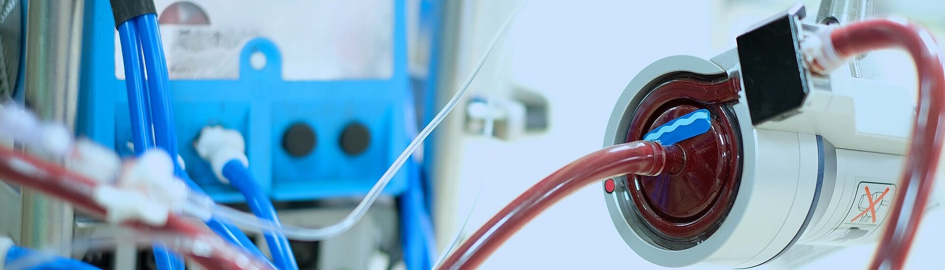 Intelligent Patient Monitoring with Ultrasonic Measurement Technology