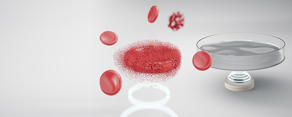 PI Ceramic Ultrasound Assisted Cell Lysis for IVD