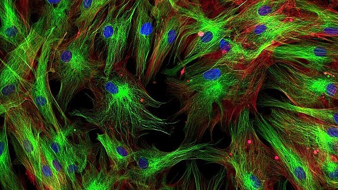 Positionierlösungen für die interne Totalreflexionsfluoreszenz-Mikroskopie (TIRFM)